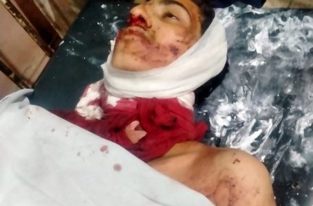 لاہور: مصری شاہ میں ایک 18 سالہ لڑکا گردن پر ڈور پھرنے سے جاں بحق